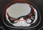 女子肚子变大以为发胖，腹痛送医从肚中取出16斤囊肿