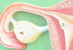 hpv病毒会跑到子宫里吗 hpv进入子宫内膜里可以存活吗